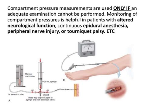 compartment syndrome compression test|how to measure compartment pressure.